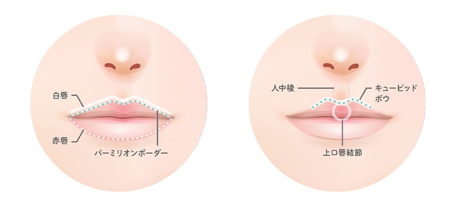 唇　ヒアルロン酸