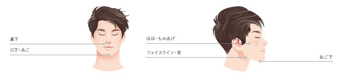 医療脱毛（男性バージョン）/顔全体