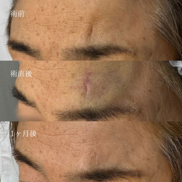施術前後2