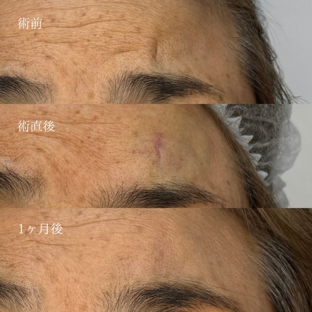 施術前後1
