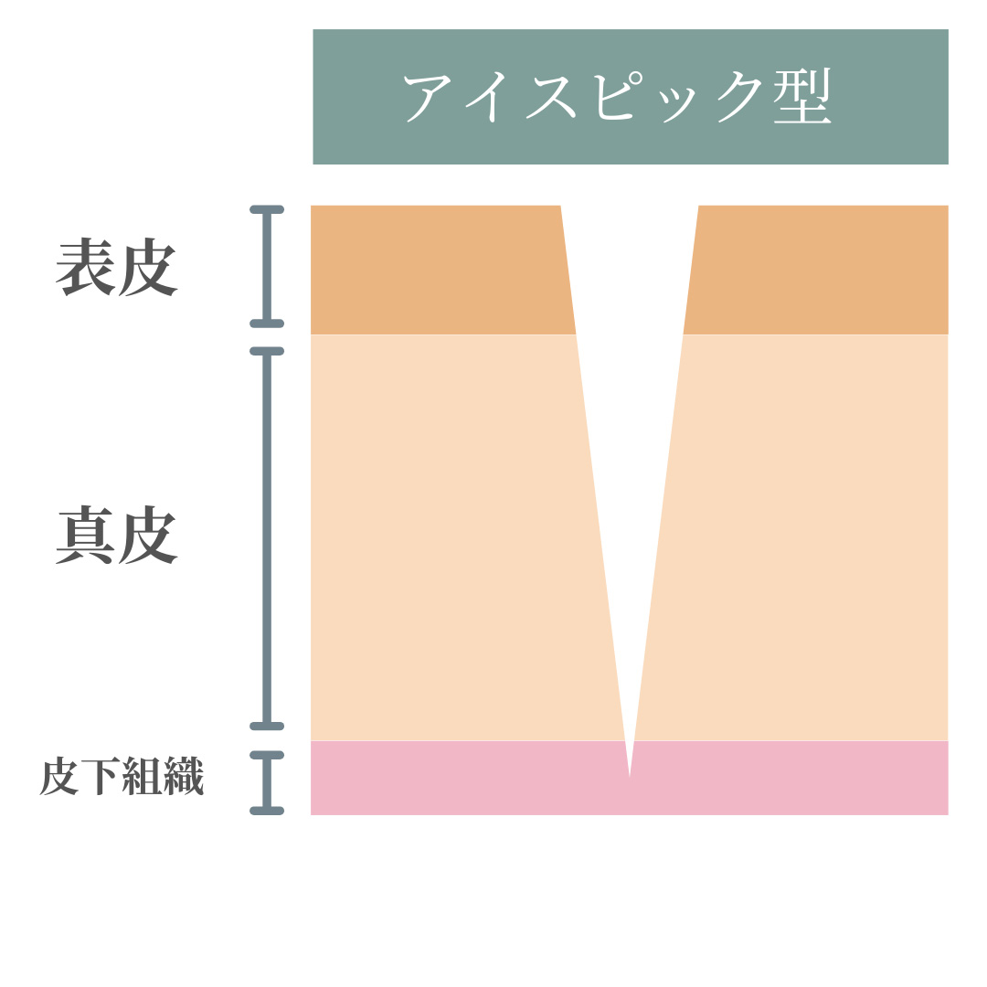 アイスピック型